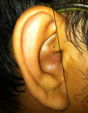 limb of helix