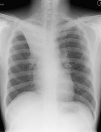 chest x-ray