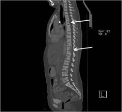 Sagittal view of whole body CT