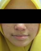Figure 1 - face
