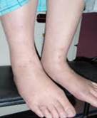 Figure 3 - feet