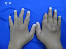 Figure 1 both fingers