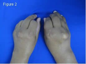 Figure 2 fingers