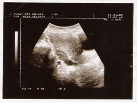 Ultrasound Image